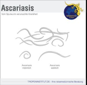 Askariasis