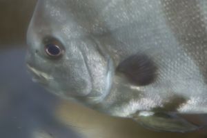 Diphyllobothriasis