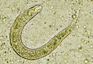 Larva migrans cutanea